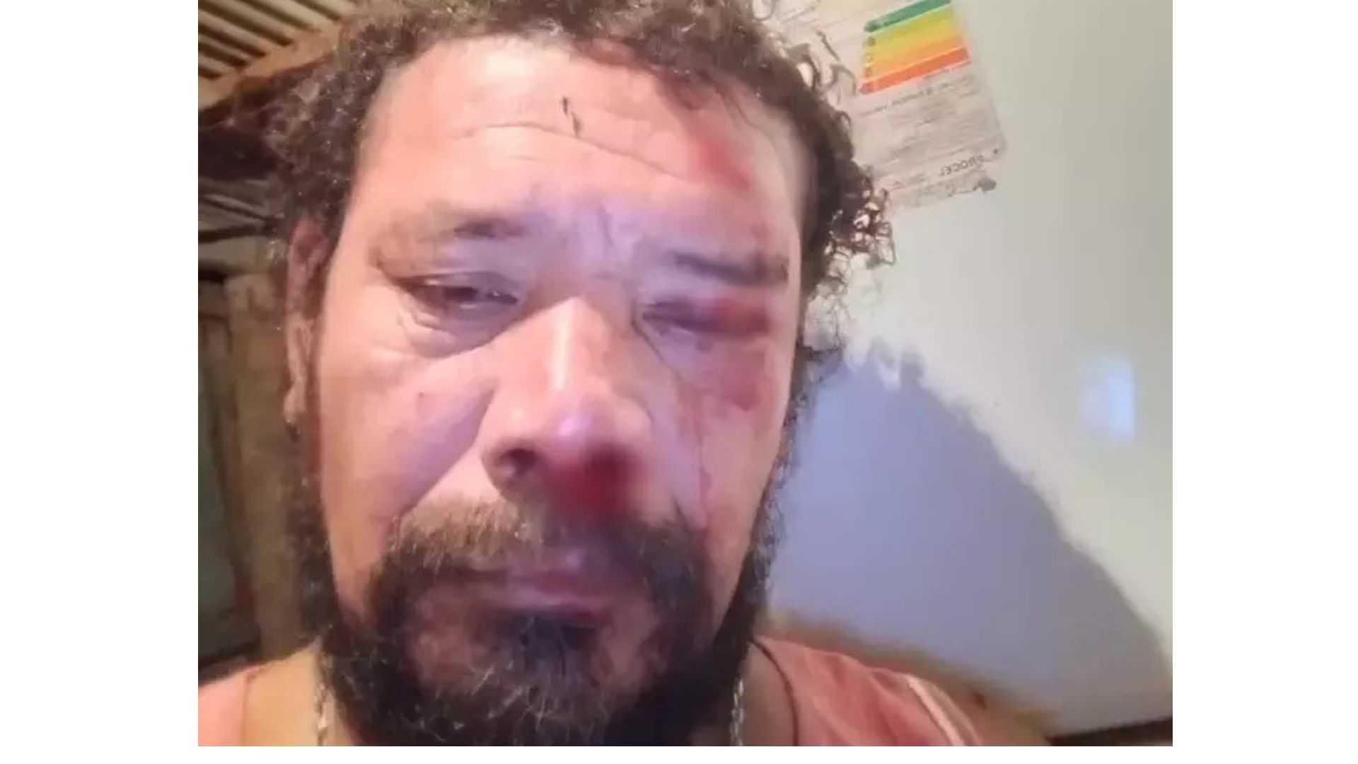 "Não desejo o que passei para ninguém", conta sobrevivente de ataque de onça