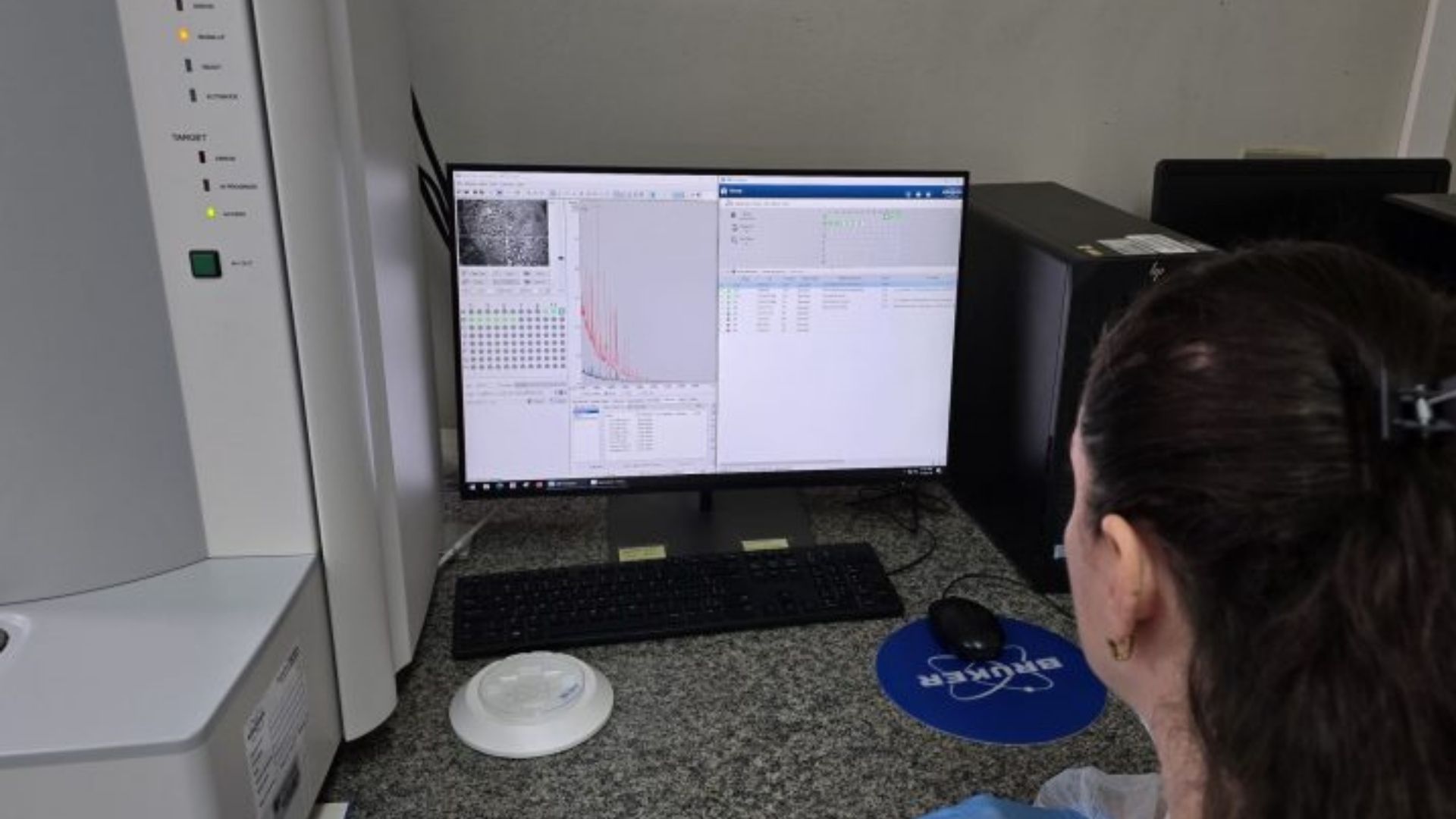 Hospital Regional de Mato Grosso do Sul inova com tecnologia que transforma diagn&oacute;sticos em horas