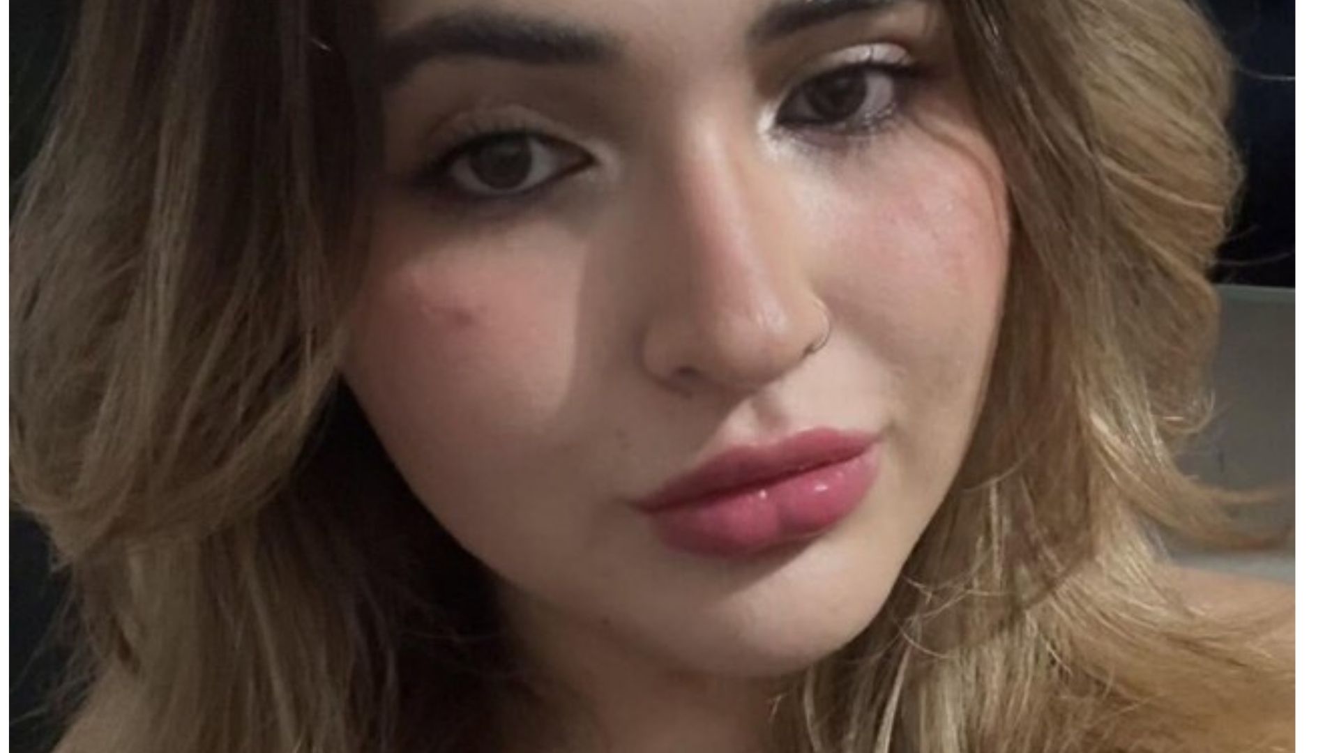 Jovem que morreu ap&oacute;s queda de tronco na cabe&ccedil;a estudava Biomedicina na Uniderp