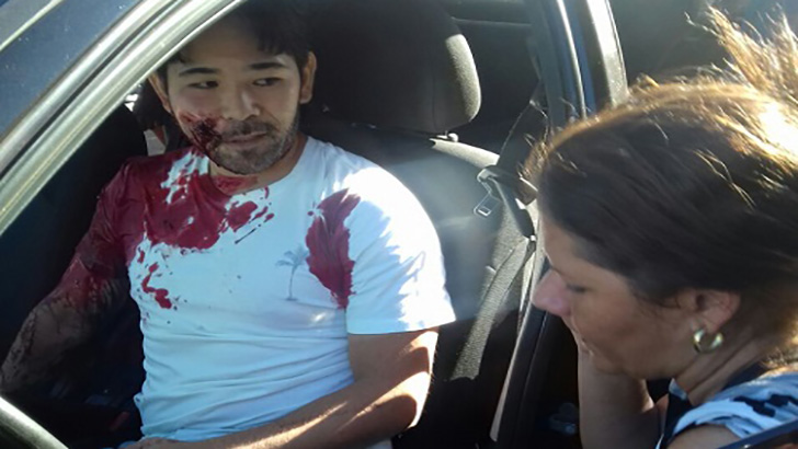 Motorista do Uber foi atingido por três tiros que atingiram o rosto, os ombros e as costas - Foto: WhatsApp/Correio do Estado /  