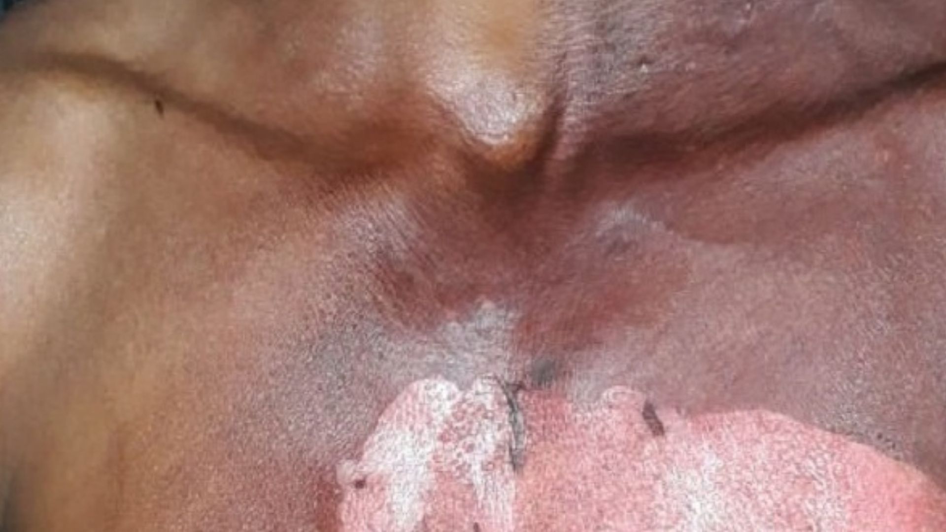 IMAGEM ILUSTRATIVA  /